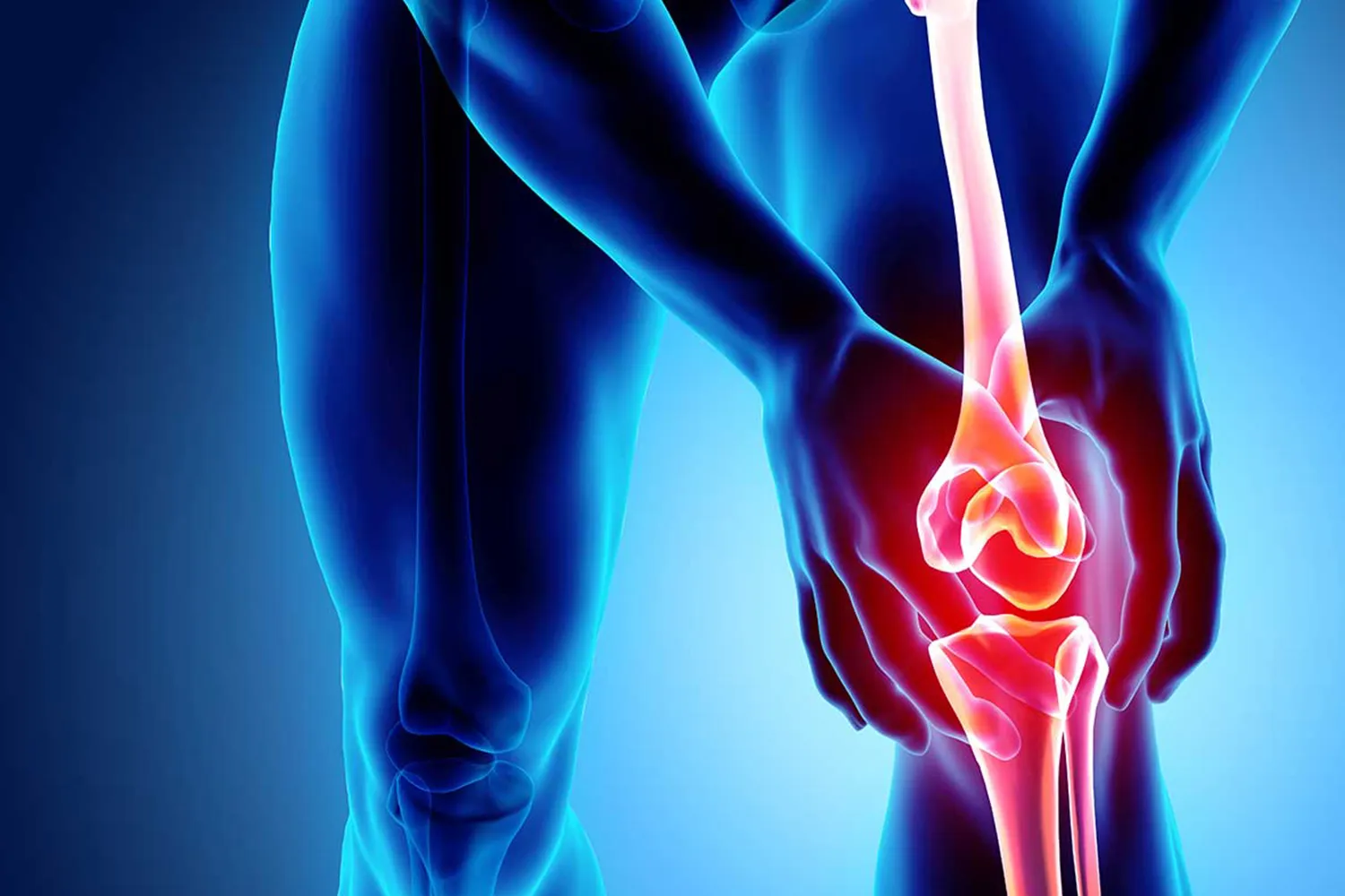 Knee pain visual